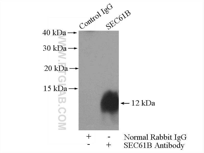 Immunoprecipitation (IP) experiment of HepG2 cells using SEC61B Polyclonal antibody (15087-1-AP)