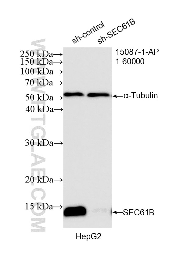 WB analysis of HepG2 using 15087-1-AP Western Blot (WB) analysis of HepG2 cells using SEC61B Polyclonal antibody (15087-1-AP)
