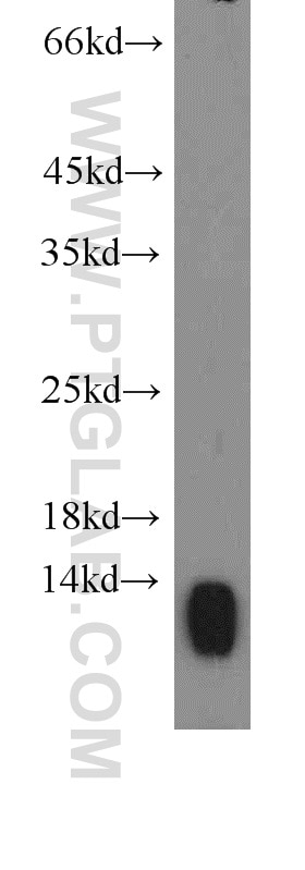 Western Blot (WB) analysis of HeLa cells using SEC61B Polyclonal antibody (15087-1-AP)