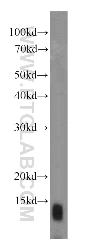 SEC61B Polyclonal antibody