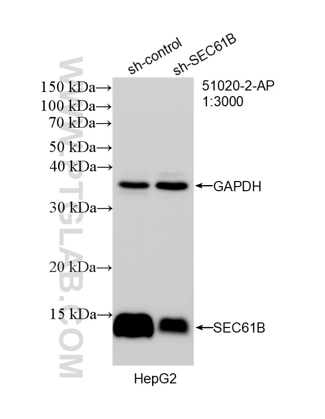 Western Blot (WB) analysis of HepG2 cells using SEC61B Polyclonal antibody (51020-2-AP)