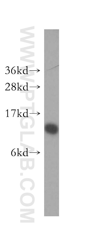 SEC61B Polyclonal antibody