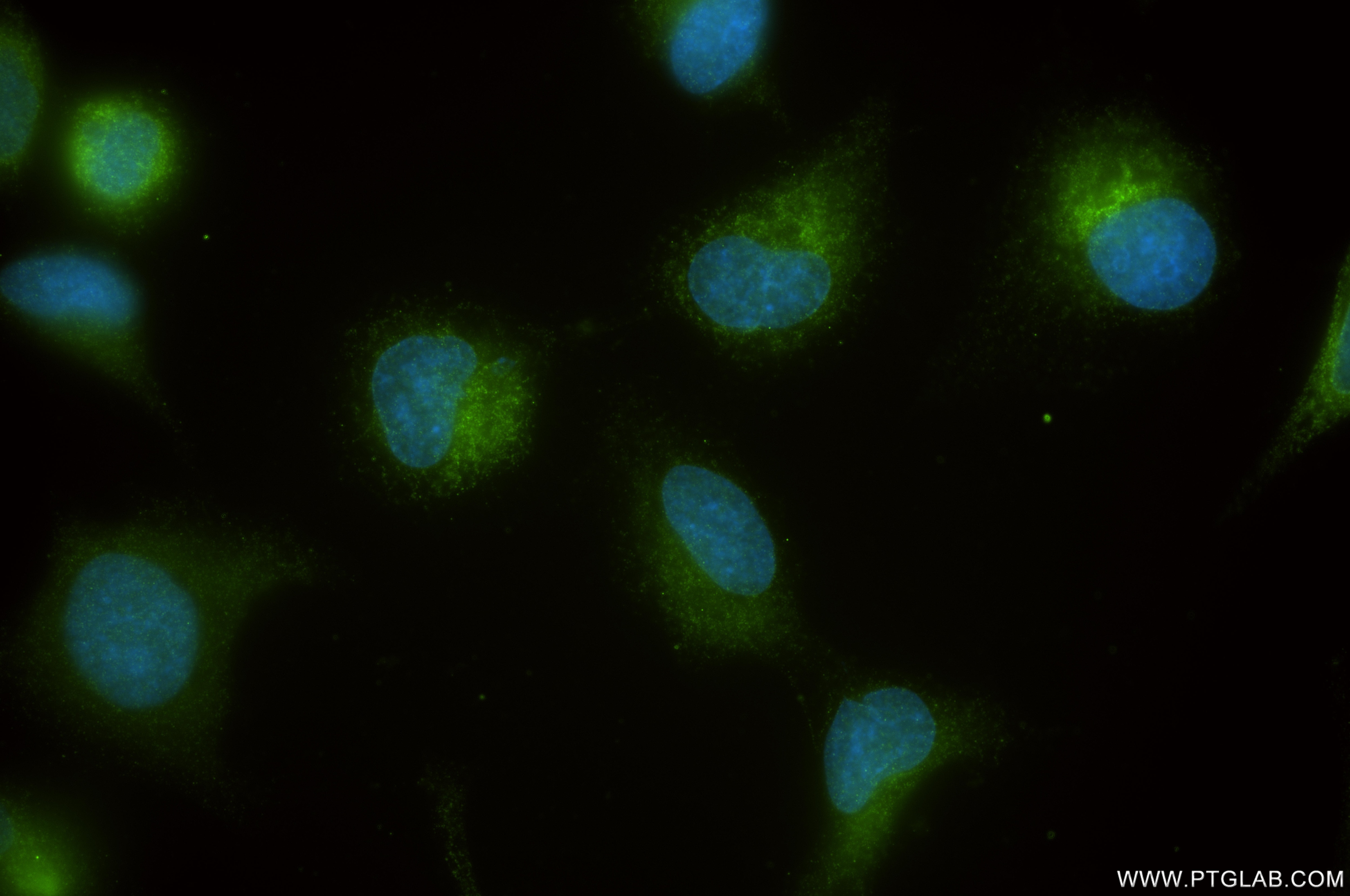 Immunofluorescence (IF) / fluorescent staining of HeLa cells using SEC61B Recombinant monoclonal antibody (85805-2-RR)