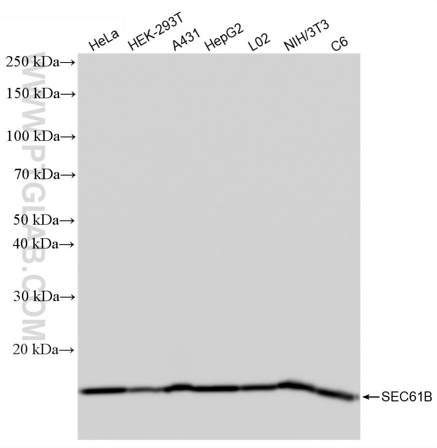 Western Blot (WB) analysis of various lysates using SEC61B Recombinant monoclonal antibody (85805-2-RR)