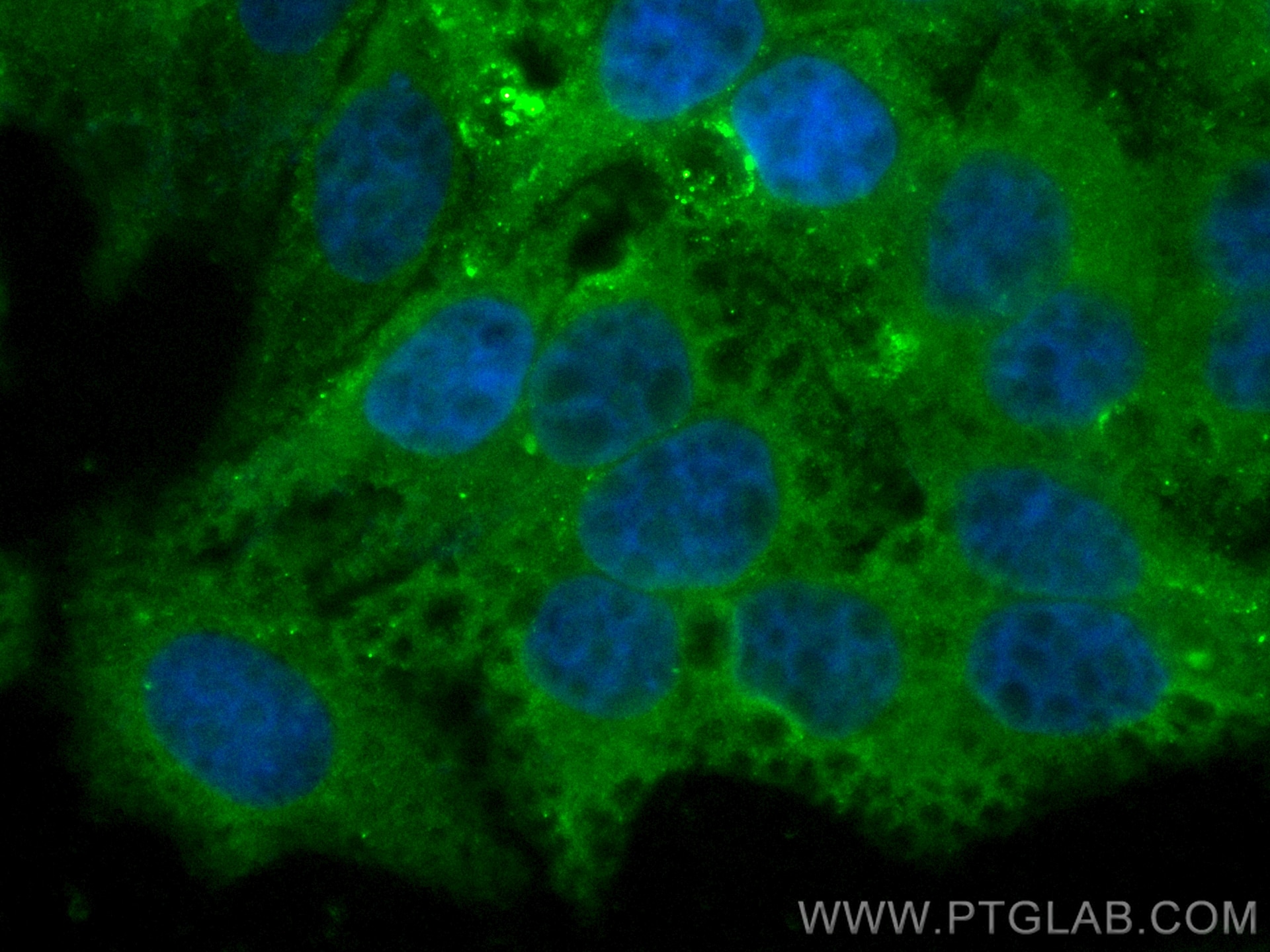 IF Staining of HepG2 using CL488-15087