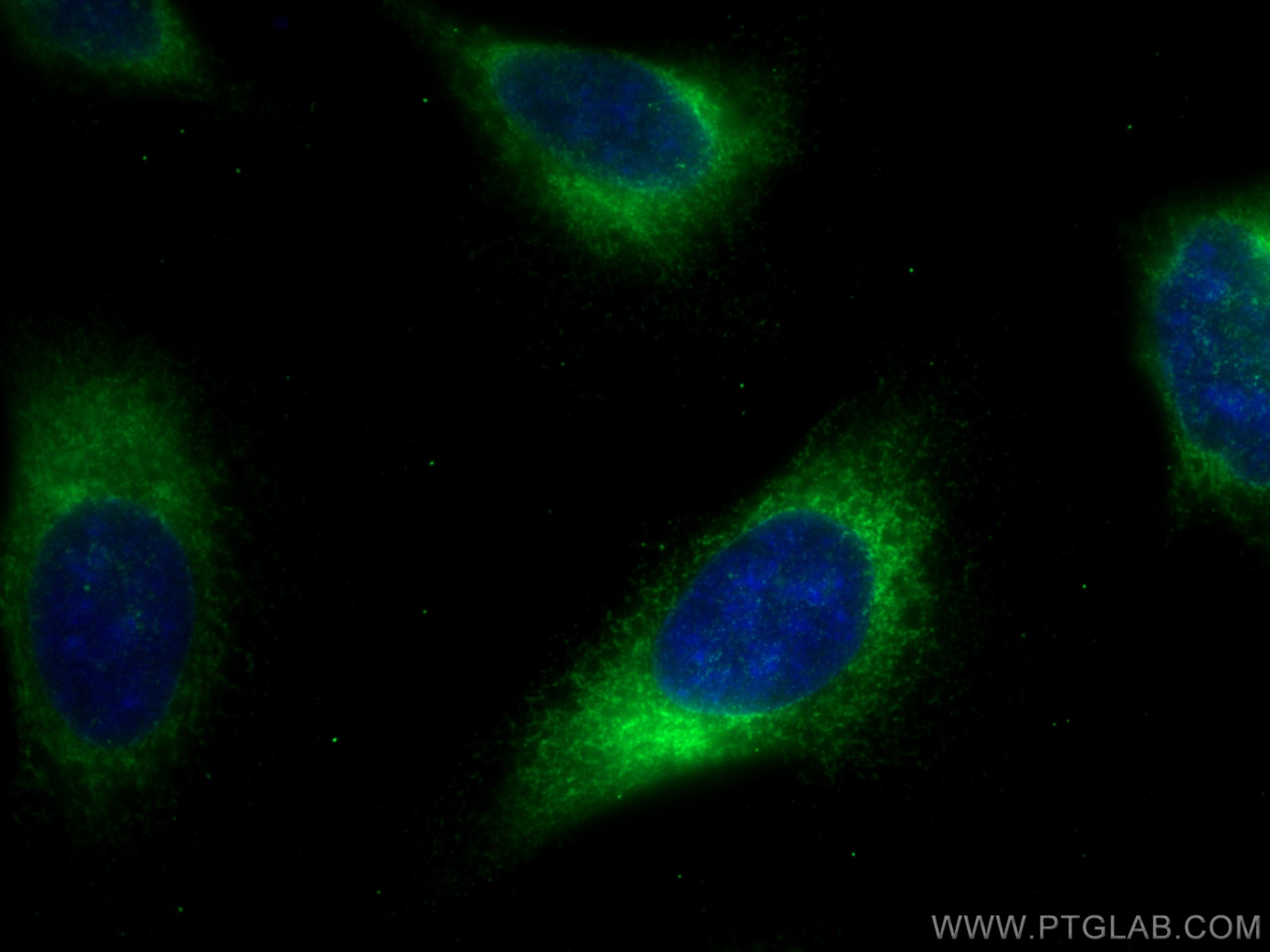 Immunofluorescence (IF) / fluorescent staining of HeLa cells using SEC61B-Specific Polyclonal antibody (14846-1-AP)
