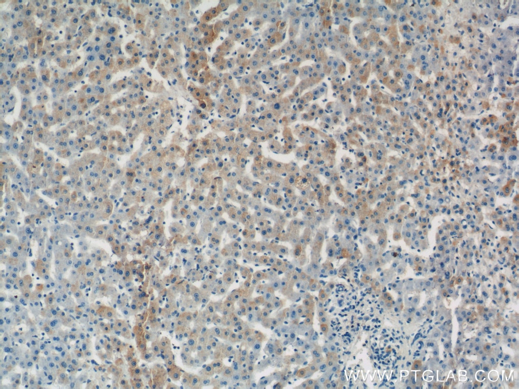 Immunohistochemistry (IHC) staining of human liver tissue using SEC61B-Specific Polyclonal antibody (14846-1-AP)