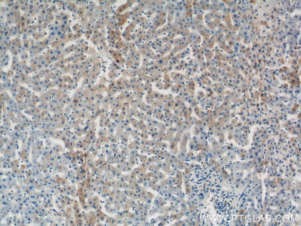 IHC staining of human liver using 14846-1-AP