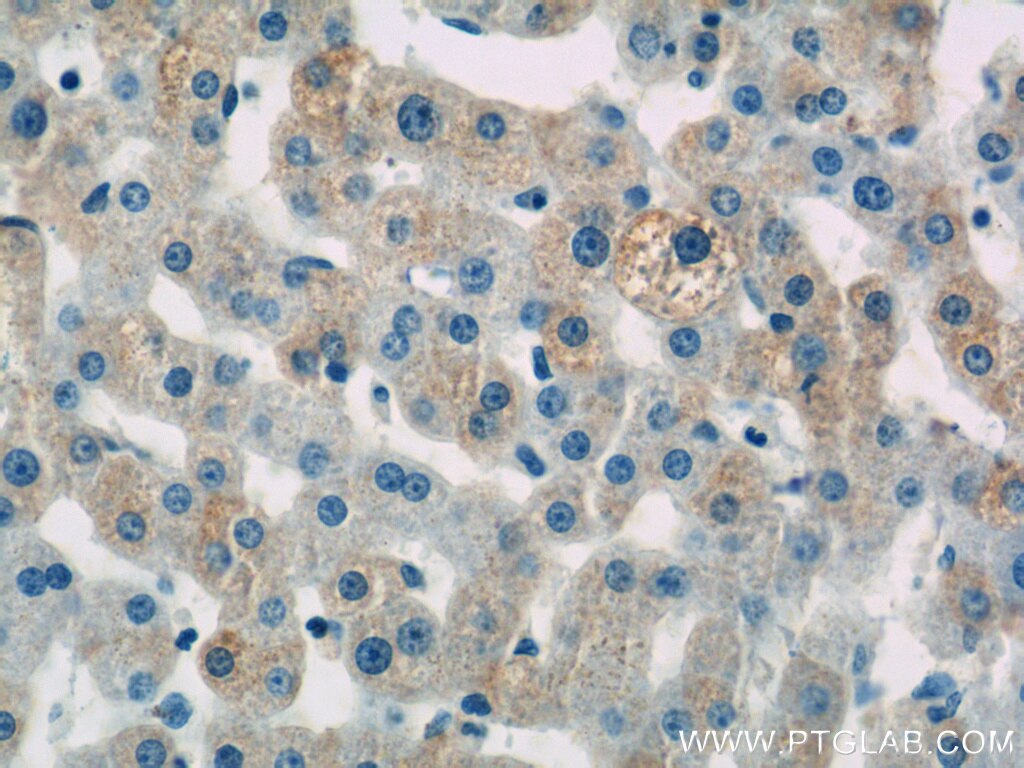 Immunohistochemistry (IHC) staining of human liver tissue using SEC61B-Specific Polyclonal antibody (14846-1-AP)