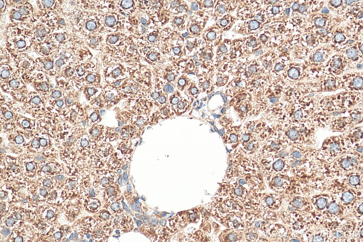 Immunohistochemistry (IHC) staining of mouse liver tissue using SEC61B-Specific Polyclonal antibody (14846-1-AP)