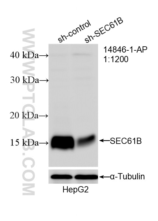 Western Blot (WB) analysis of HepG2 cells using SEC61B-Specific Polyclonal antibody (14846-1-AP)
