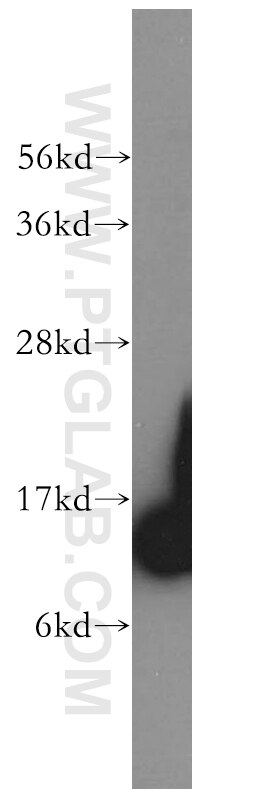 Western Blot (WB) analysis of HeLa cells using SEC61B-Specific Polyclonal antibody (14846-1-AP)