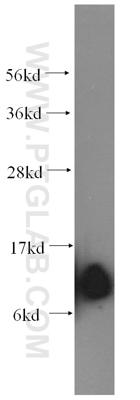 Western Blot (WB) analysis of human kidney tissue using SEC61B-Specific Polyclonal antibody (14846-1-AP)