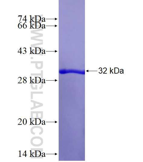 SEC61G fusion protein Ag1624 SDS-PAGE