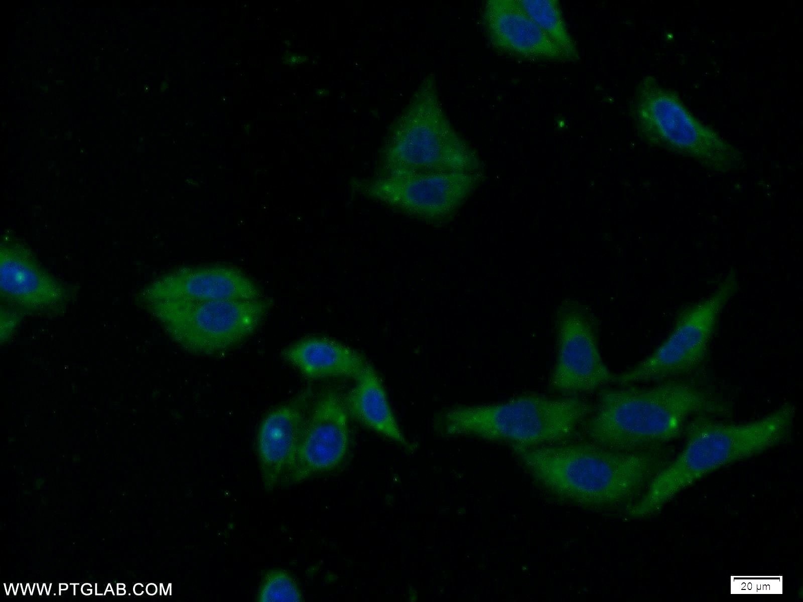 Immunofluorescence (IF) / fluorescent staining of HepG2 cells using SEC61 Alpha Polyclonal antibody (24935-1-AP)