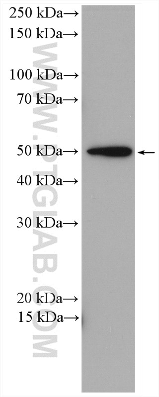 Western Blot (WB) analysis of U2OS cells using SEC61 Alpha Polyclonal antibody (24935-1-AP)