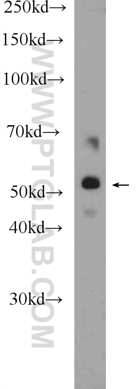 Western Blot (WB) analysis of HEK-293 cells using SEC61 Alpha Polyclonal antibody (24935-1-AP)