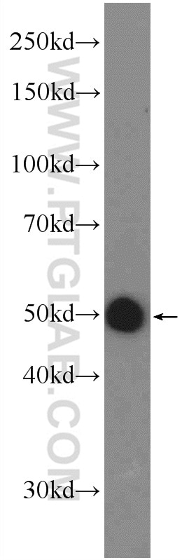 Western Blot (WB) analysis of mouse brain tissue using SEC61 Alpha Polyclonal antibody (24935-1-AP)