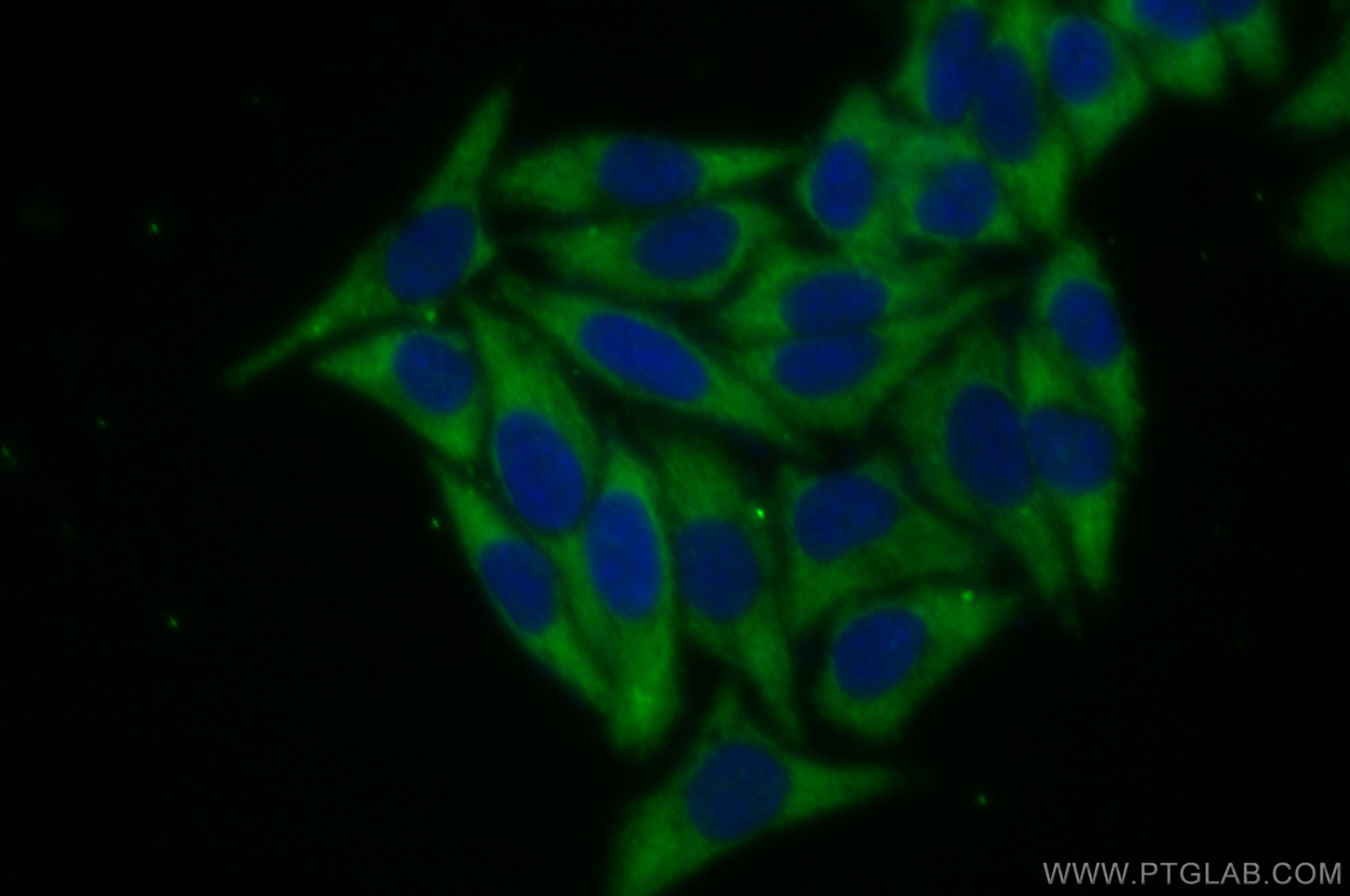 Immunofluorescence (IF) / fluorescent staining of HepG2 cells using SEC62 Polyclonal antibody (28693-1-AP)