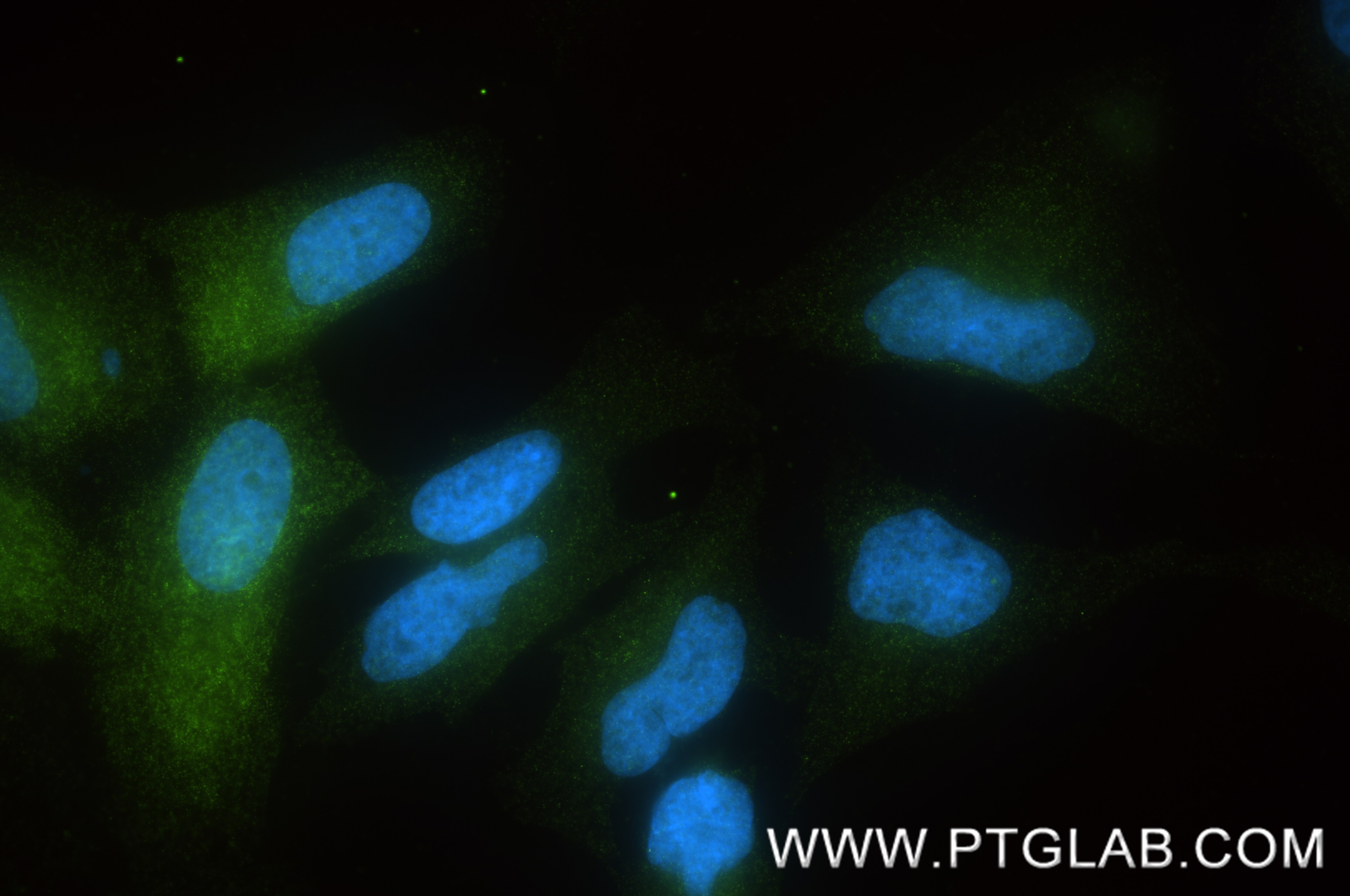 IF Staining of HeLa using 87925-1-RR Immunofluorescence (IF) / fluorescent staining of HeLa cells using SEC62 Recombinant monoclonal antibody (87925-1-RR)