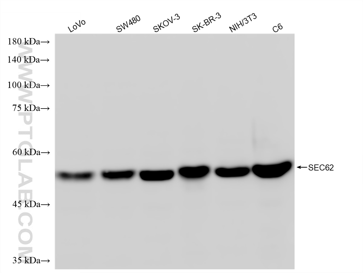WB analysis using 87925-1-RR Western Blot (WB) analysis of various lysates using SEC62 Recombinant monoclonal antibody (87925-1-RR)