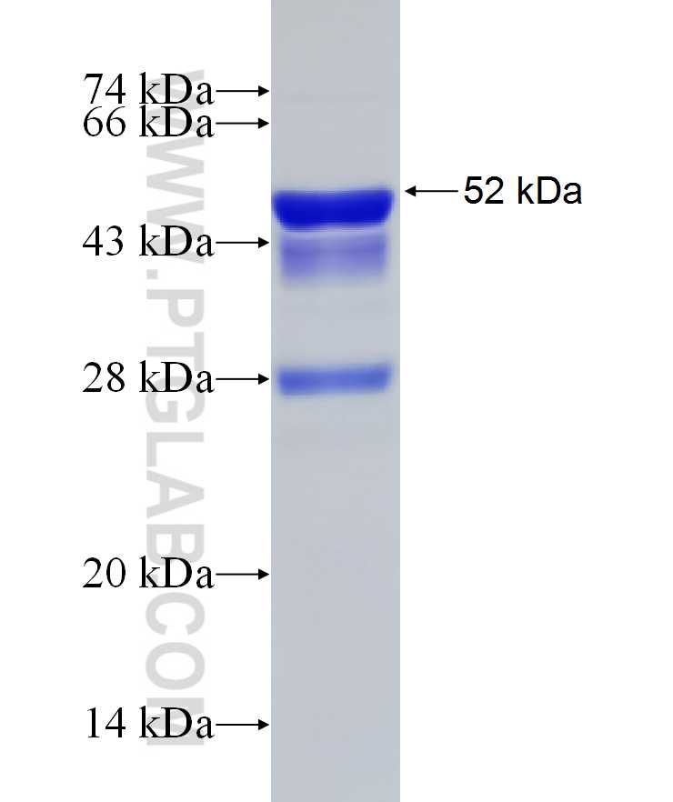 SEC62 fusion protein Ag29932 SDS-PAGE