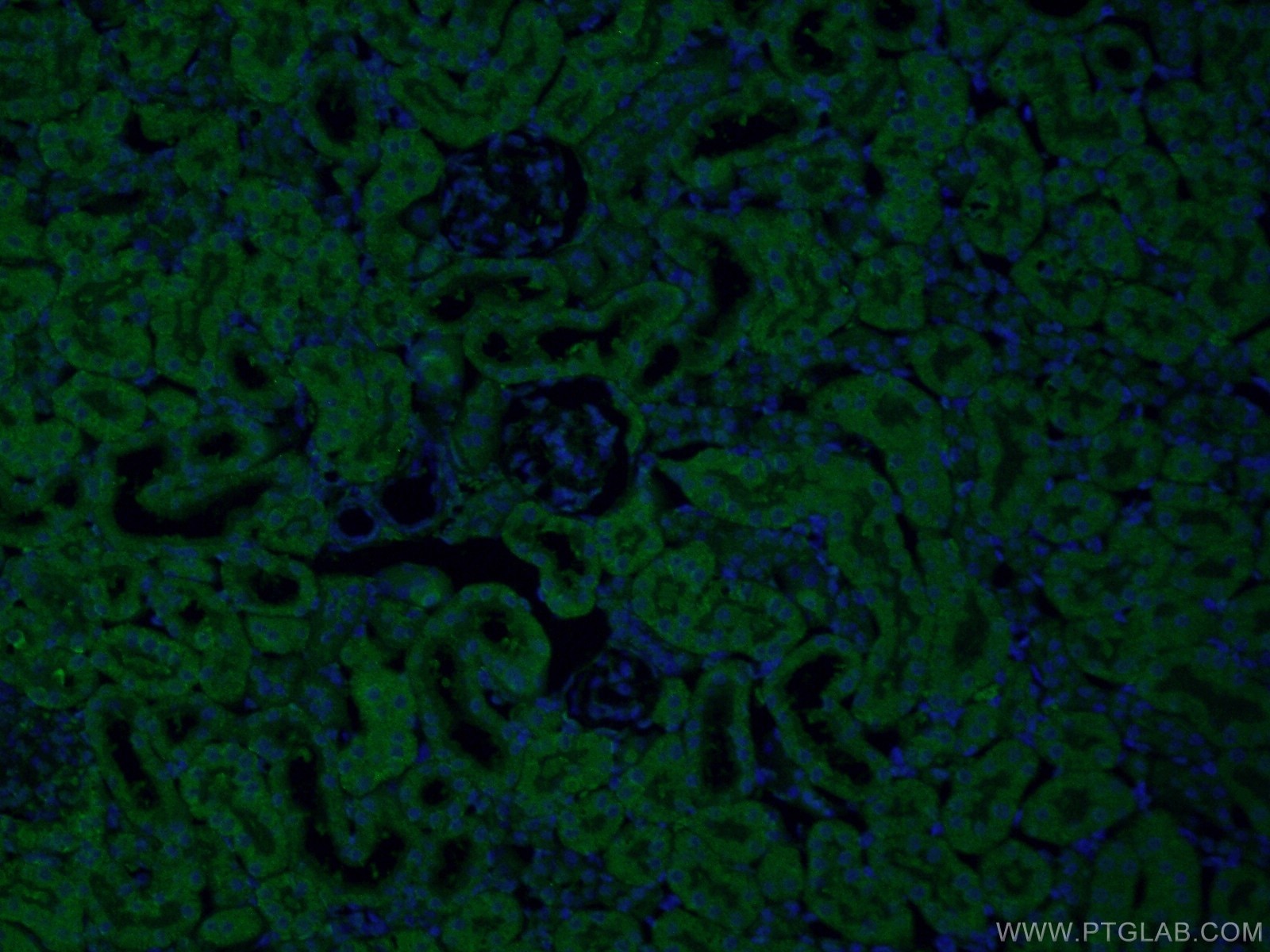 Immunofluorescence (IF) / fluorescent staining of mouse kidney tissue using SEC63 Polyclonal antibody (13978-1-AP)
