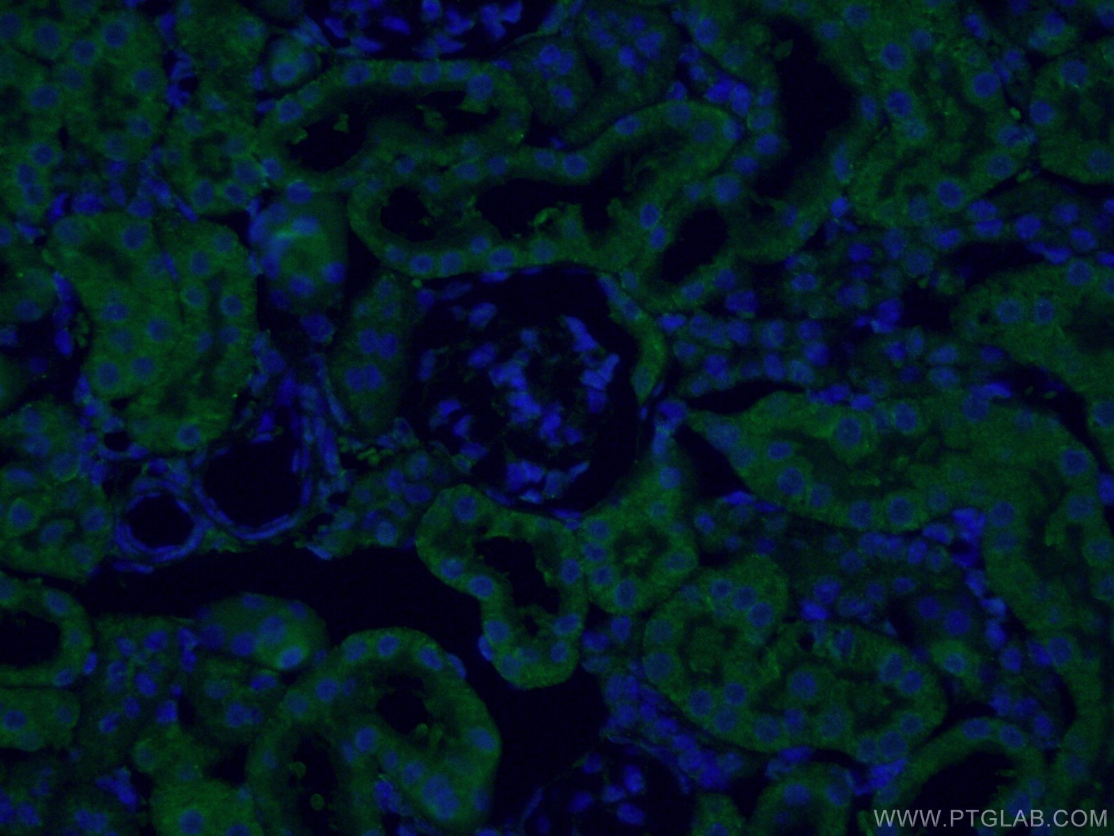 IF Staining of mouse kidney using 13978-1-AP