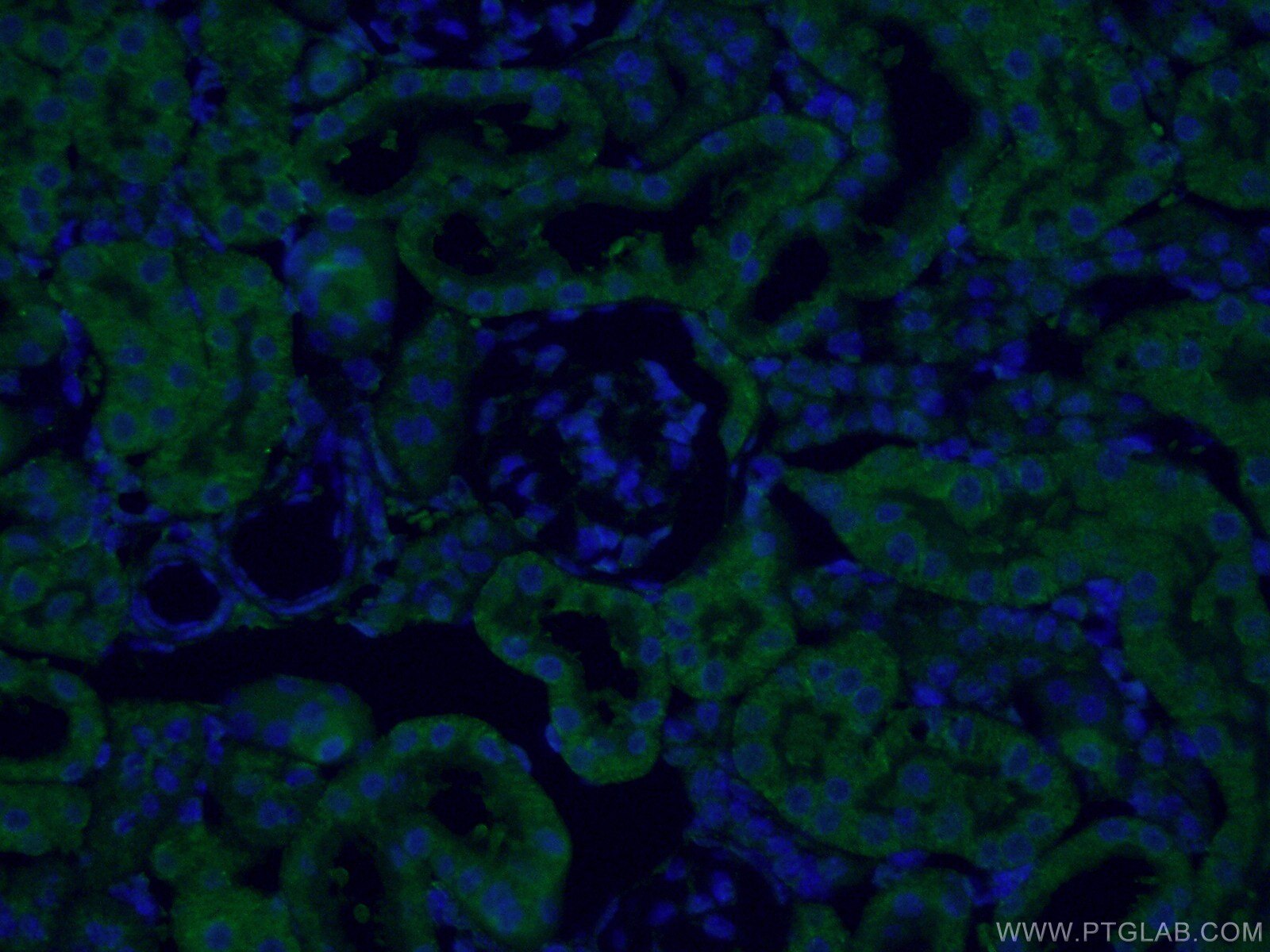 Immunofluorescence (IF) / fluorescent staining of mouse kidney tissue using SEC63 Polyclonal antibody (13978-1-AP)