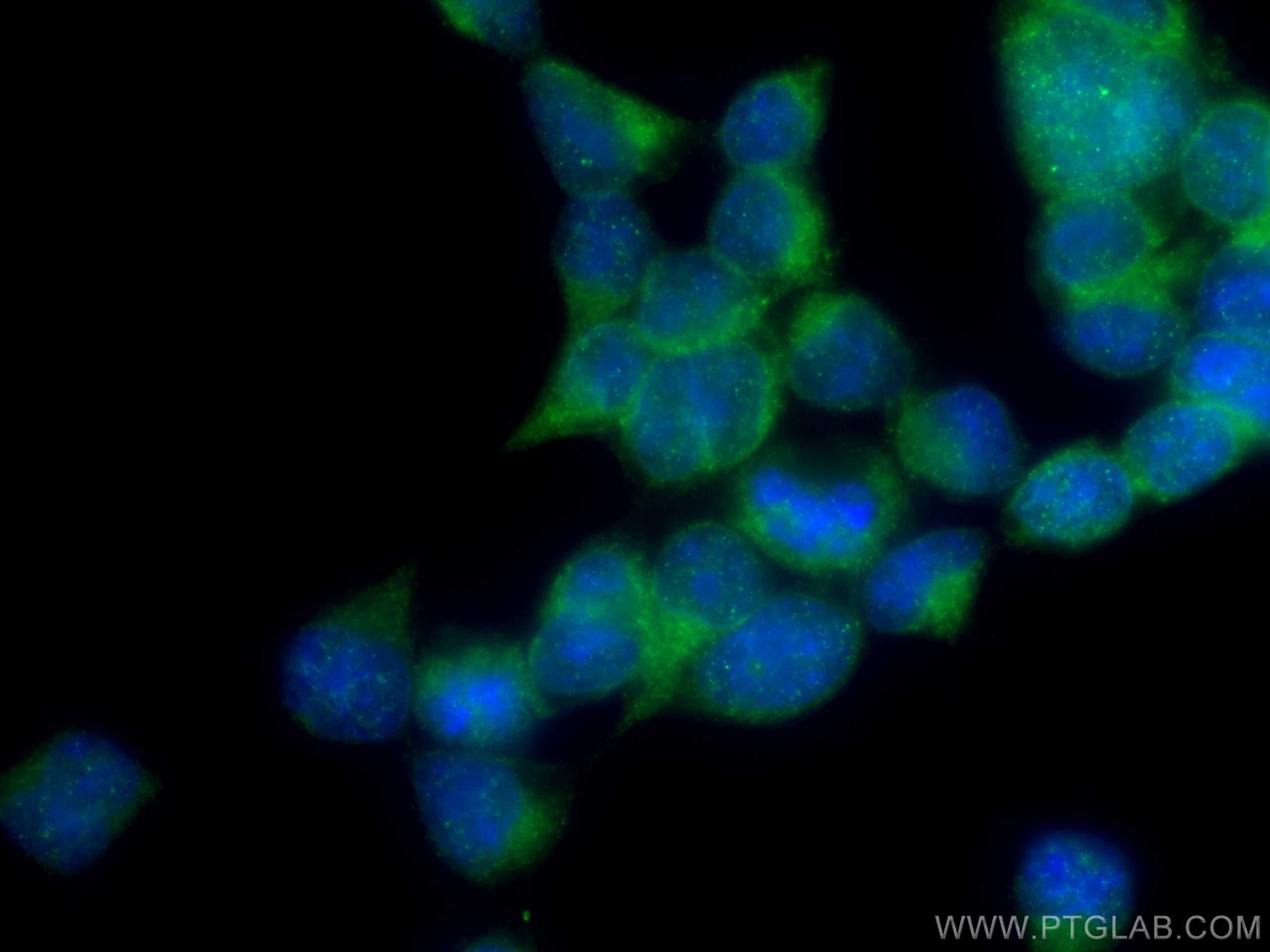 Immunofluorescence (IF) / fluorescent staining of HEK-293 cells using SEC63 Polyclonal antibody (13978-1-AP)
