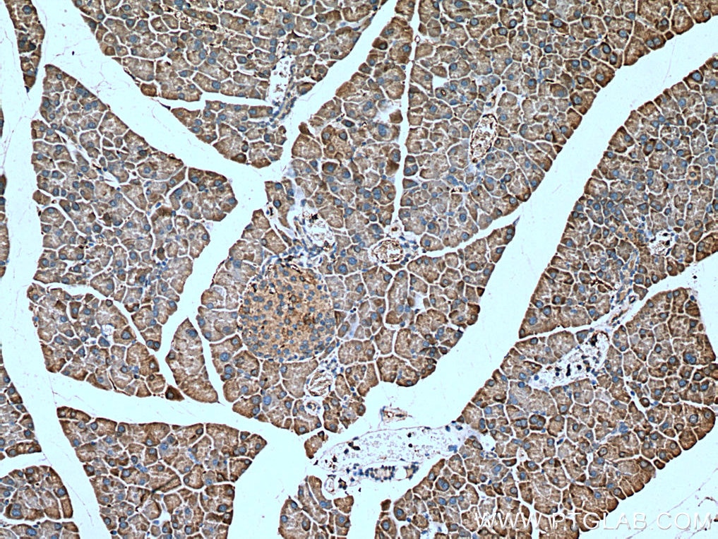 Immunohistochemistry (IHC) staining of mouse pancreas tissue using SEC63 Polyclonal antibody (13978-1-AP)