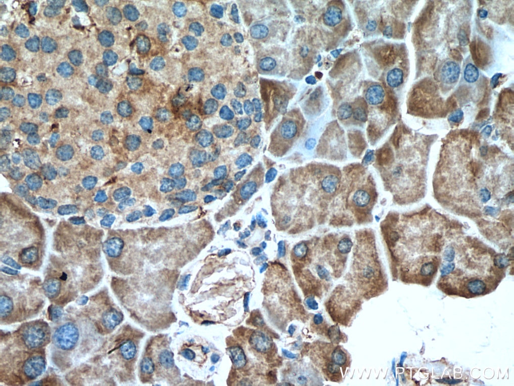 Immunohistochemistry (IHC) staining of mouse pancreas tissue using SEC63 Polyclonal antibody (13978-1-AP)