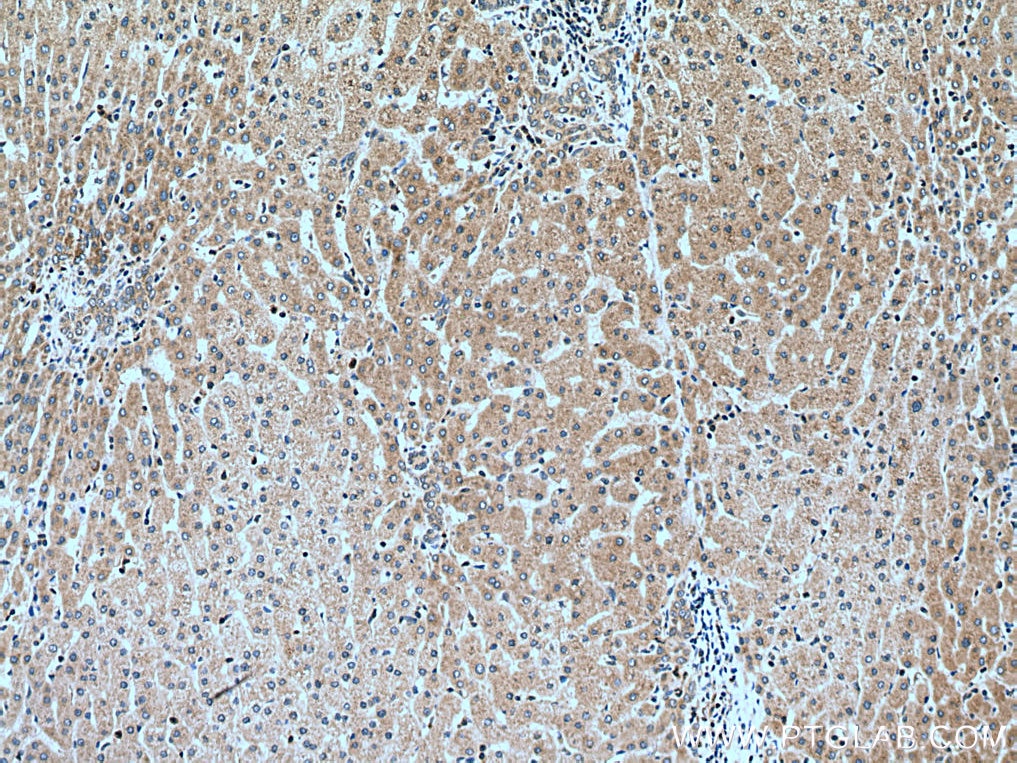 Immunohistochemistry (IHC) staining of human liver tissue using SEC63 Polyclonal antibody (13978-1-AP)