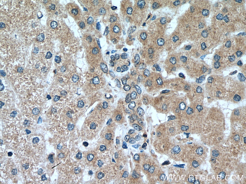Immunohistochemistry (IHC) staining of human liver tissue using SEC63 Polyclonal antibody (13978-1-AP)