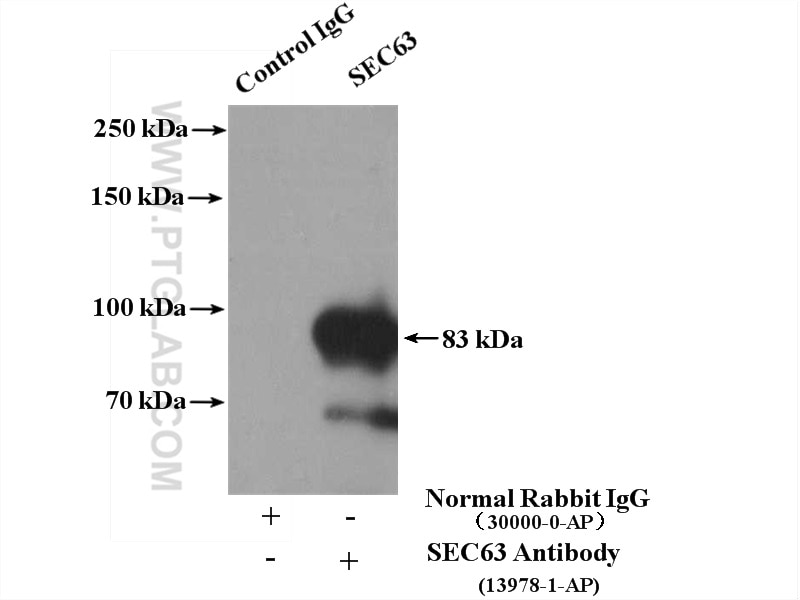 Immunoprecipitation (IP) experiment of A431 cells using SEC63 Polyclonal antibody (13978-1-AP)