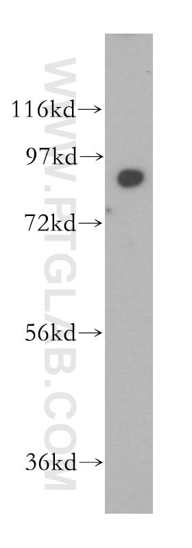 Western Blot (WB) analysis of HEK-293 cells using SEC63 Polyclonal antibody (13978-1-AP)