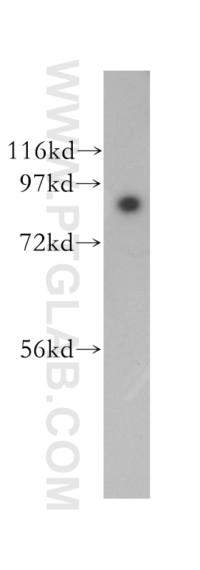 Western Blot (WB) analysis of A431 cells using SEC63 Polyclonal antibody (13978-1-AP)
