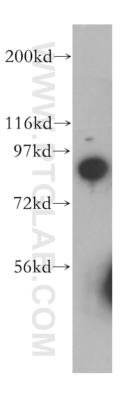 Western Blot (WB) analysis of PC-3 cells using SEC63 Polyclonal antibody (13978-1-AP)