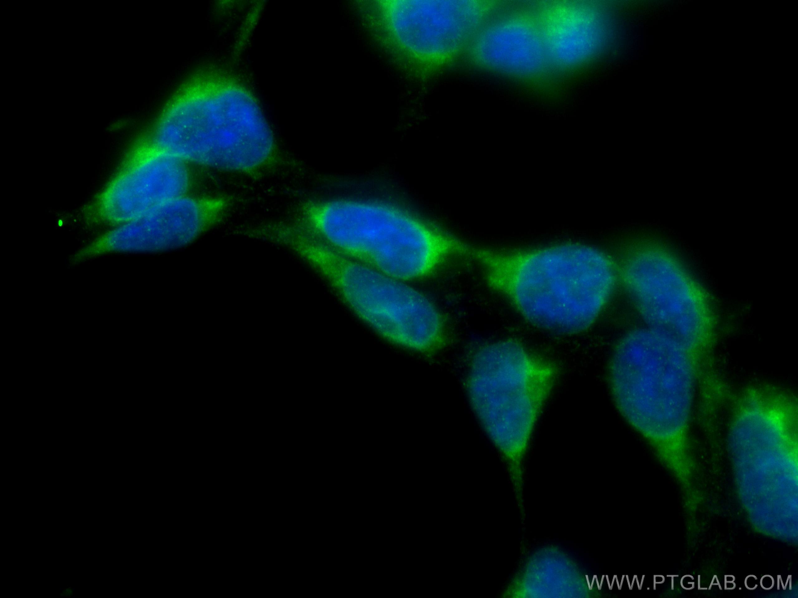 Immunofluorescence (IF) / fluorescent staining of HEK-293 cells using SEC63 Polyclonal antibody (28665-1-AP)