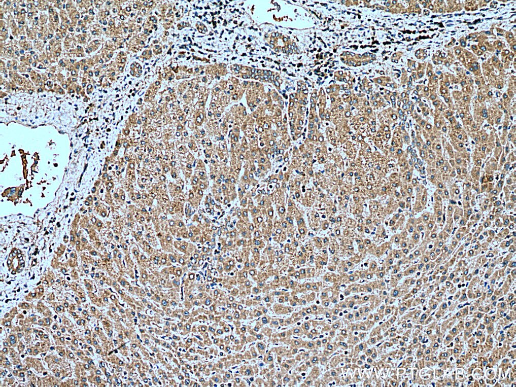 Immunohistochemistry (IHC) staining of human liver tissue using SEC63 Polyclonal antibody (28665-1-AP)