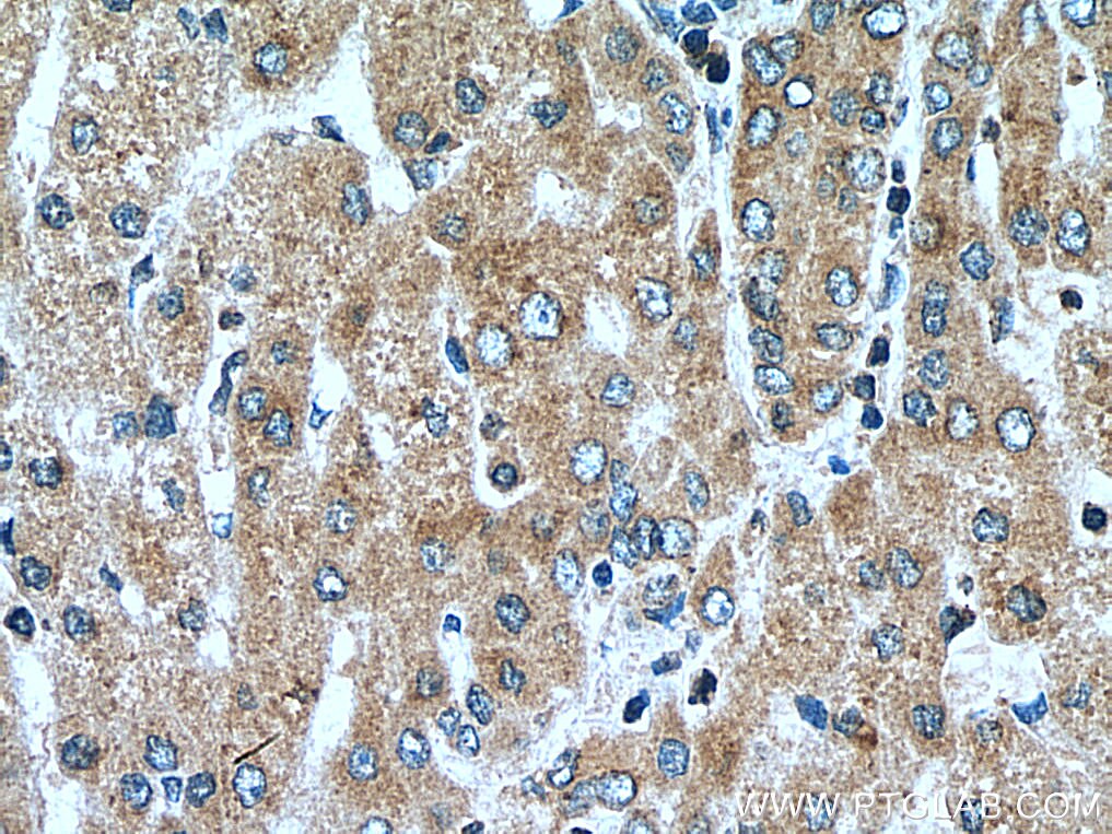 Immunohistochemistry (IHC) staining of human liver tissue using SEC63 Polyclonal antibody (28665-1-AP)