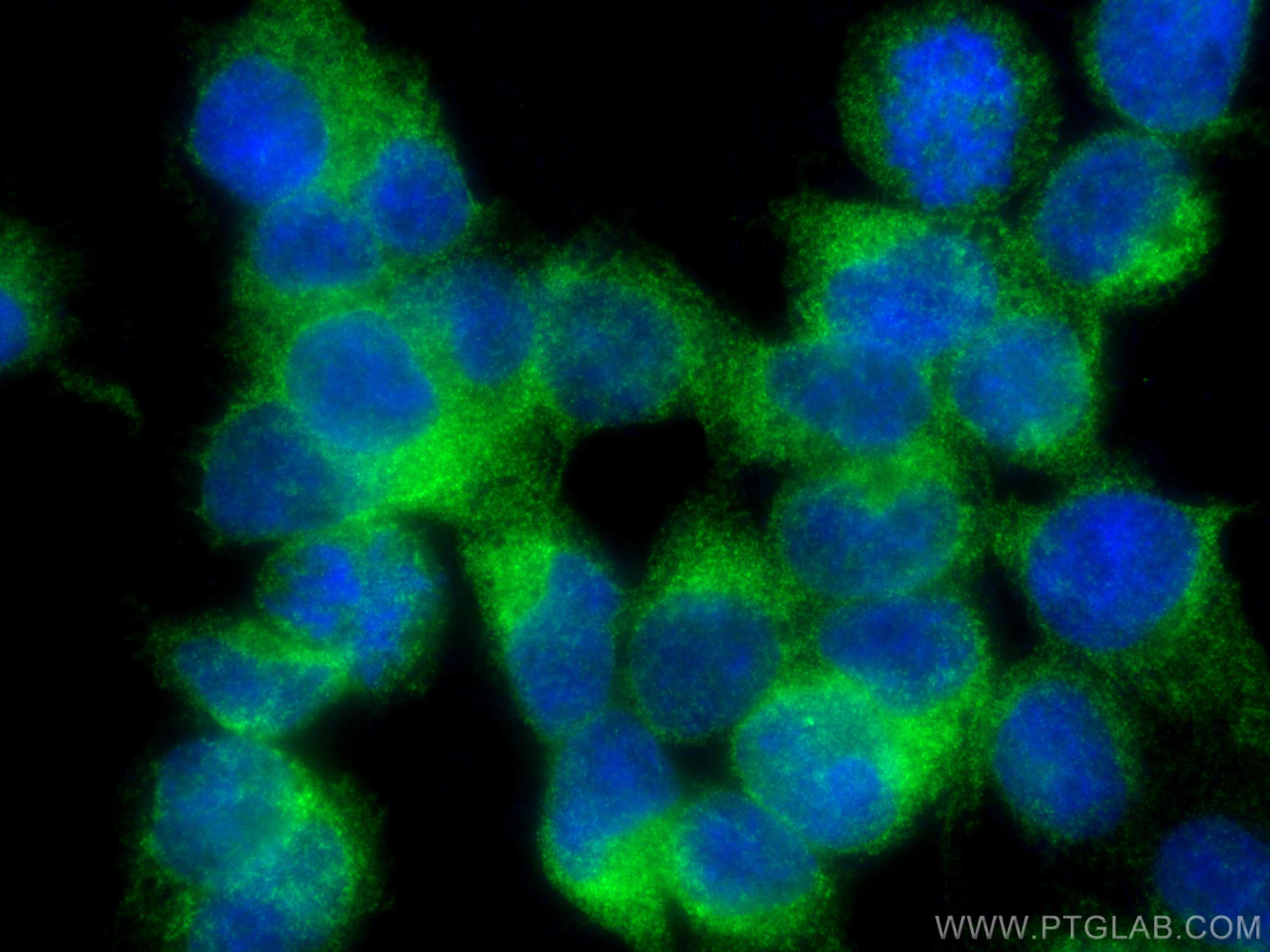 Immunofluorescence (IF) / fluorescent staining of HEK-293 cells using SEC63 Monoclonal antibody (67352-1-Ig)