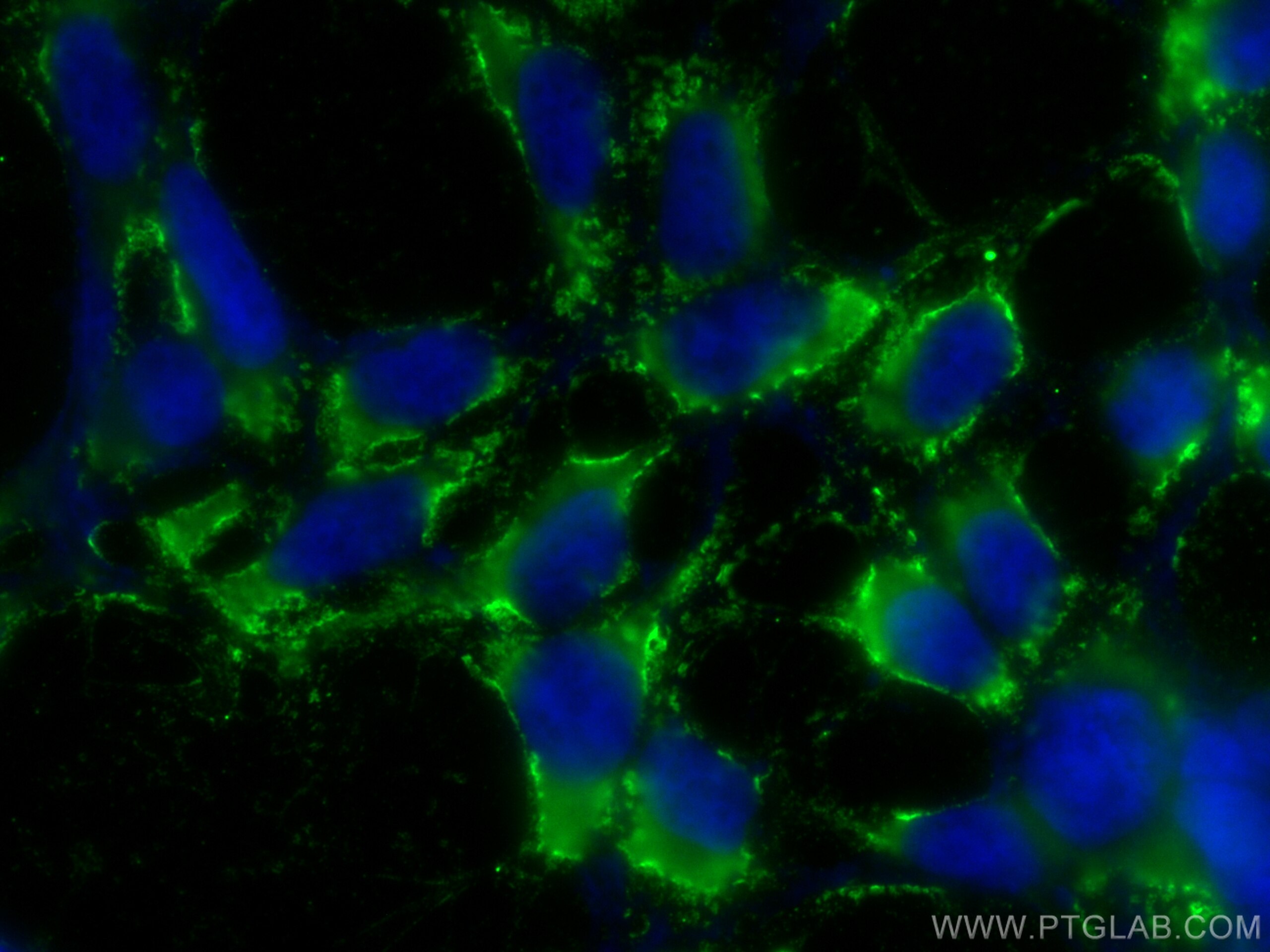 Immunofluorescence (IF) / fluorescent staining of HEK-293 cells using CoraLite® Plus 488-conjugated SEC63 Monoclonal ant (CL488-67352)