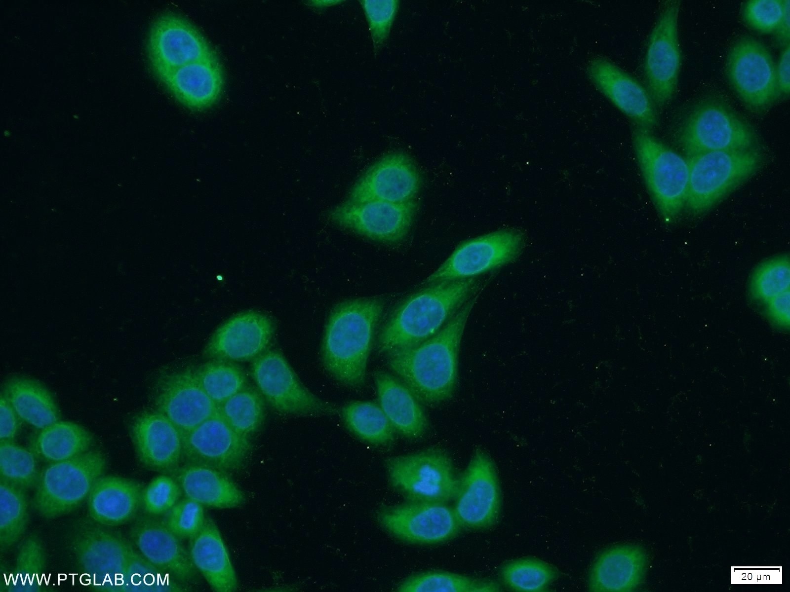 Immunofluorescence (IF) / fluorescent staining of HeLa cells using SECISBP2 Polyclonal antibody (12798-1-AP)