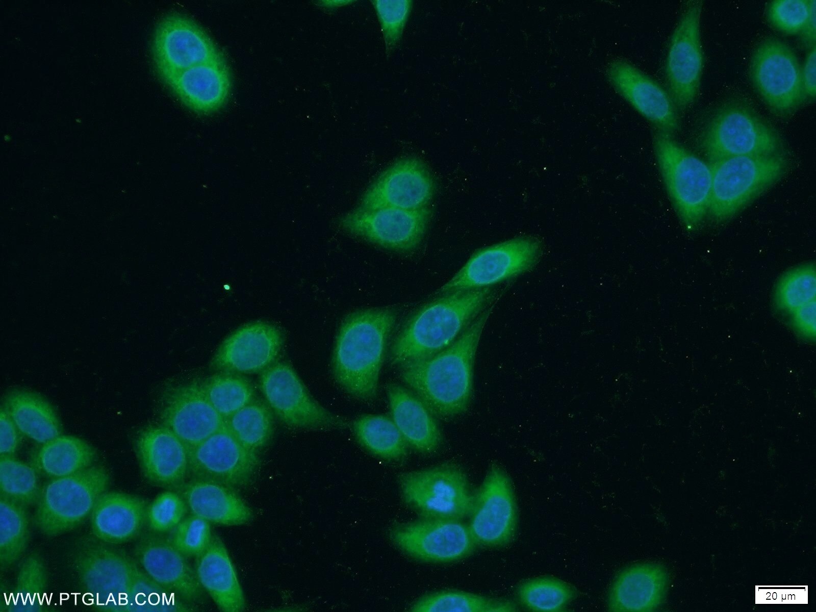 IF Staining of HeLa using 12798-1-AP