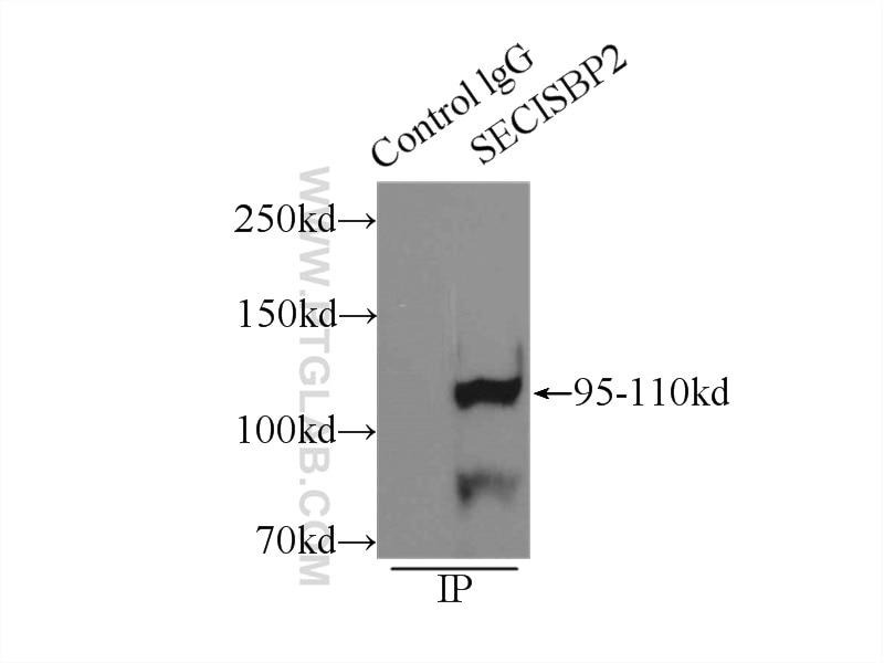 Immunoprecipitation (IP) experiment of mouse testis tissue using SECISBP2 Polyclonal antibody (12798-1-AP)