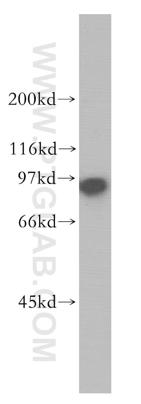 Western Blot (WB) analysis of Jurkat cells using SECISBP2 Polyclonal antibody (12798-1-AP)