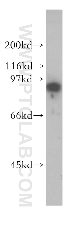 Western Blot (WB) analysis of human kidney tissue using SECISBP2 Polyclonal antibody (12798-1-AP)