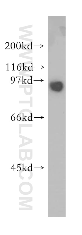 Western Blot (WB) analysis of HeLa cells using SECISBP2 Polyclonal antibody (12798-1-AP)