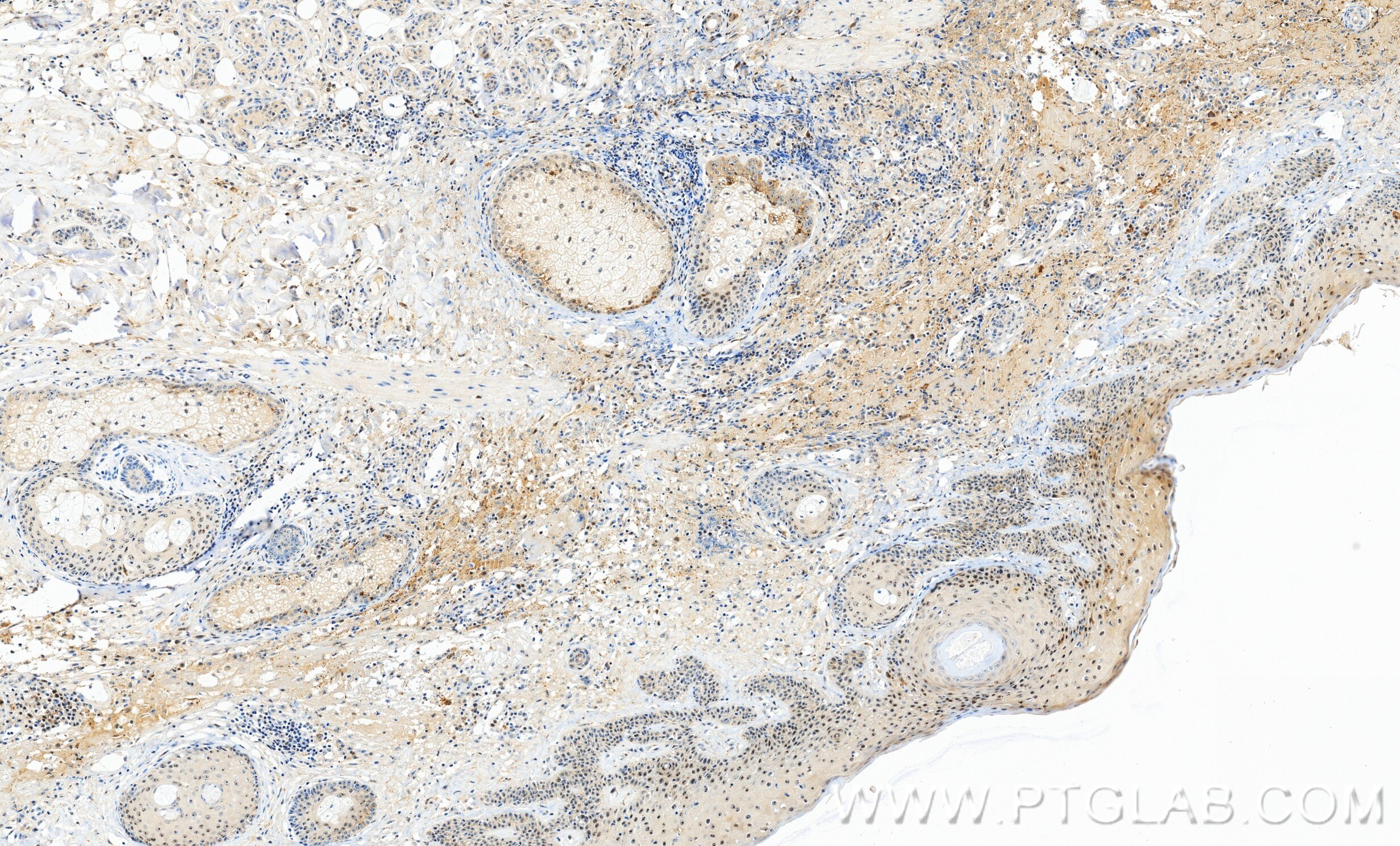 Immunohistochemistry (IHC) staining of human skin tissue using SECISBP2 Recombinant monoclonal antibody (86488-1-RR)